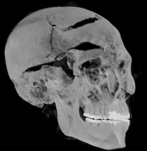 Resuelven misterioso asesinato de faraón egipcio 6 faraon egipcios