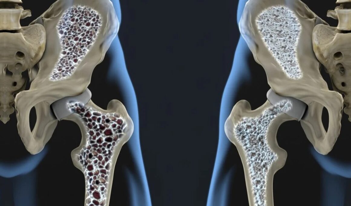 Científicas hueso osteoporosis tejido óseo regenera